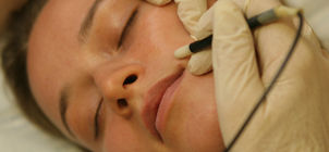 Threading and Electrolysis Hair Removal - Dyanna Spa NYC